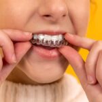 Frequently asked questions: Demystifying invisible aligners